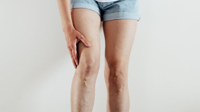 Woman with tired painful leg