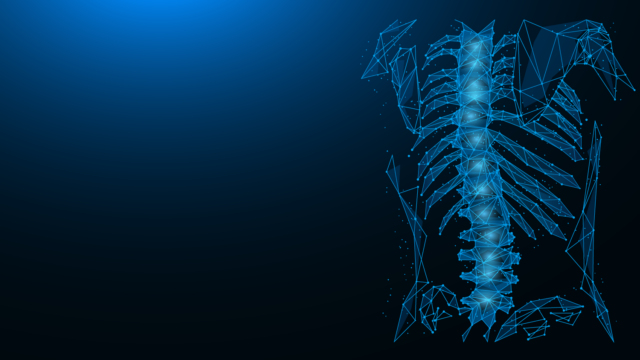 Posterior Thoracolumbar Fixation spinal rendering