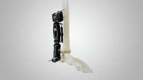 XCaliber Articulated Ankle Fixator