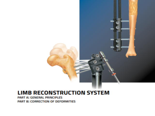 limb reconstruction system