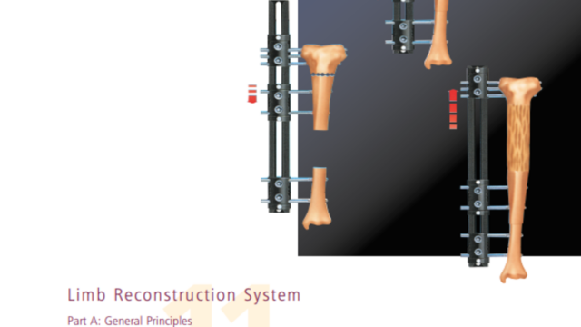 limb reconstruction system general principles