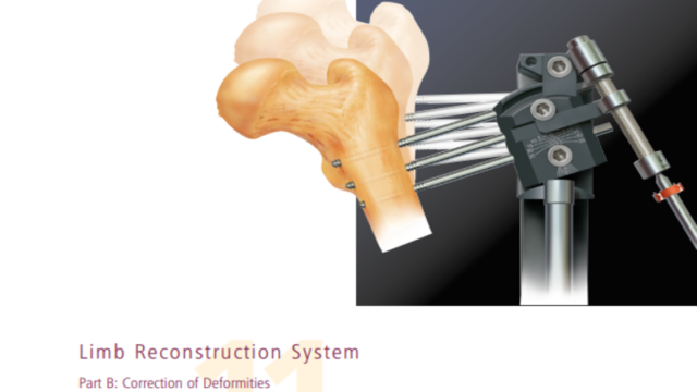 limb reconstruction system correction of deformities