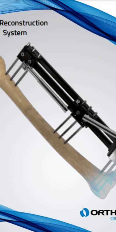 limb reconstruction system