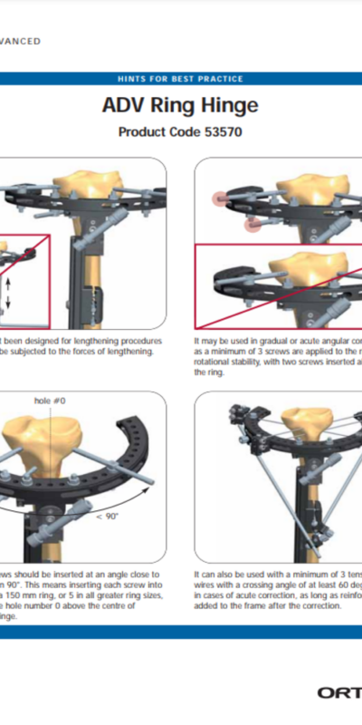 ADV ring hinge
