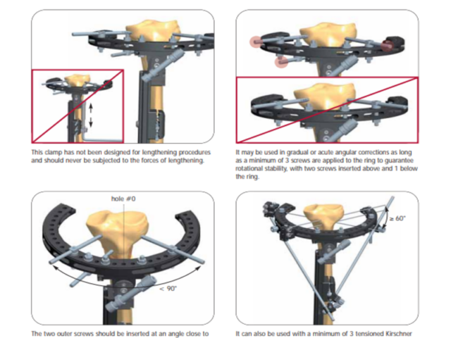 ADV ring hinge