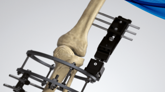 LRS advanced knee hinge