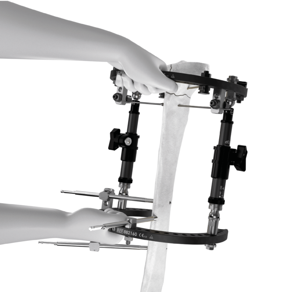 TrueLok EVO versatile frame configuration example
