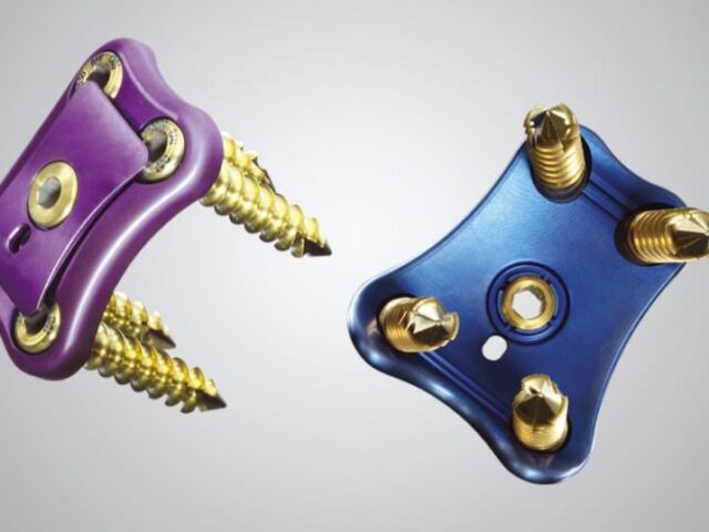Unity Lumbosacral Fixation System