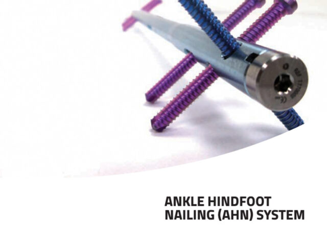 Ankle Hindfoot Nailing (AHN) System operative technique