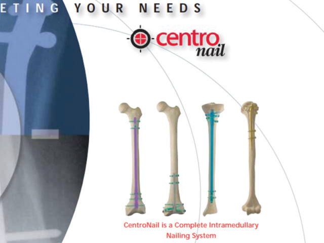 Centronail Titanium Humeral Nail brochure