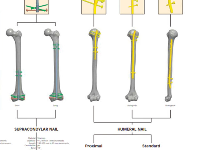 Centronail Titanium Humeral Nail chart