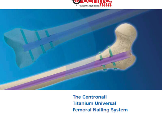Centronail Titanium Femoral Nail