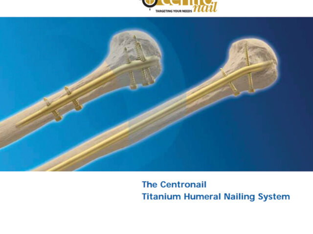 Centronail Titanium Humeral Nail system