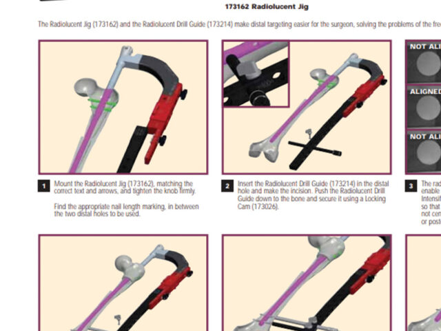 Centronail guided distal targeting system
