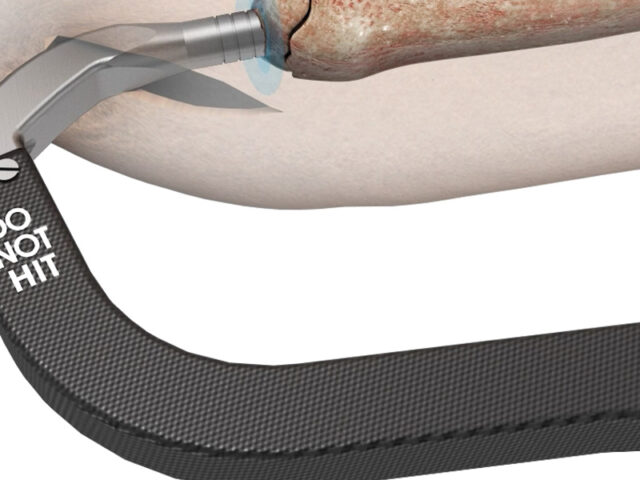 Chimaera Hip Fracture System bone close up