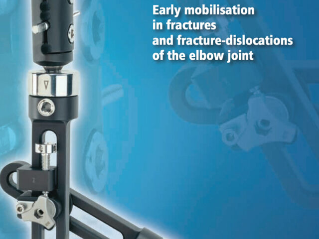 Elbow Fixator instrument