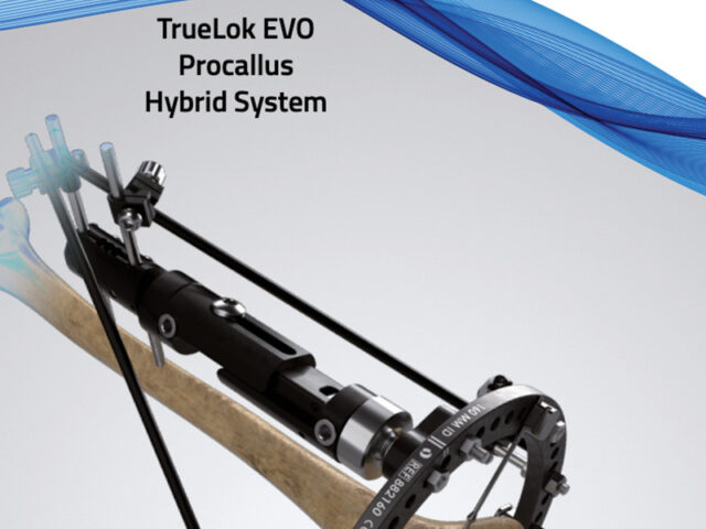 Opus Mg Set Osteoconductive Scaffold hybrid system