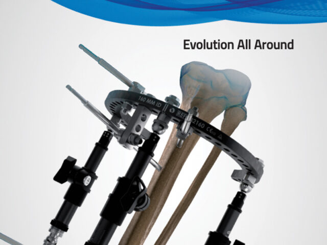 TrueLok EVO ring fixation system trifold
