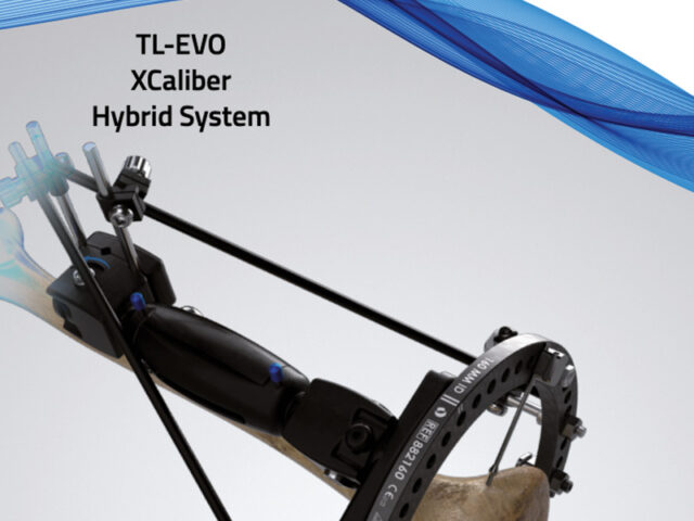 TrueLok EVO ring fixation system operative technique