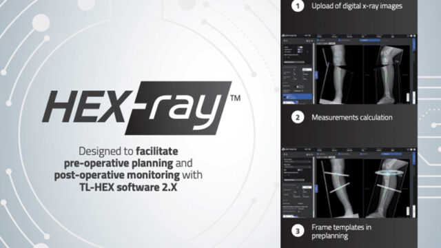 HEX-Ray brochure
