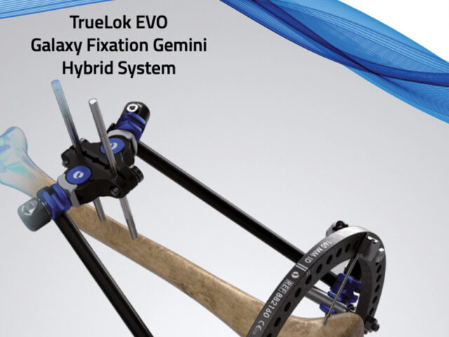 TrueLok EVO hybrid system