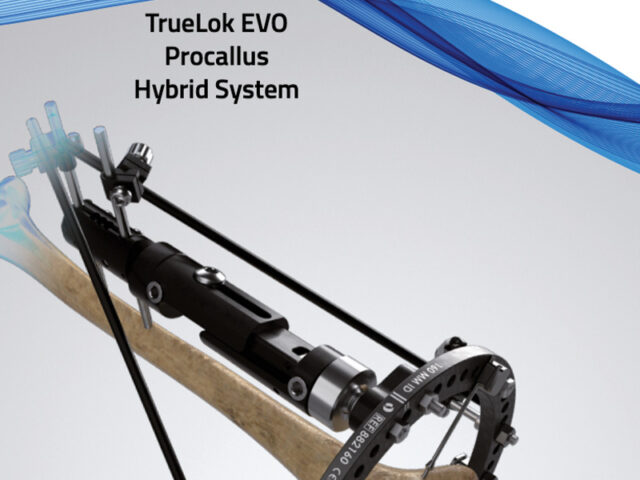 TrueLok EVO system