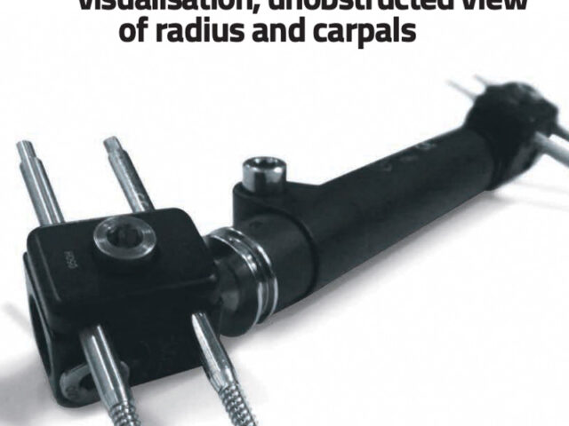 RadioLucent Wrist Fixator close up