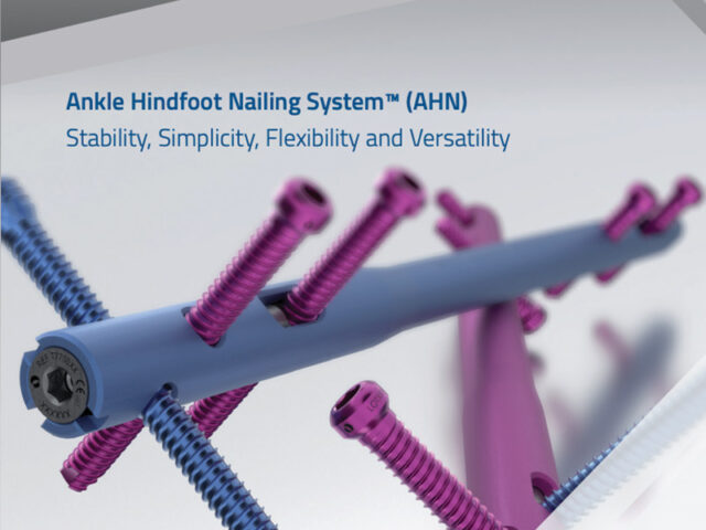 Ankle Hindfoot Nailing (AHN) System brochure