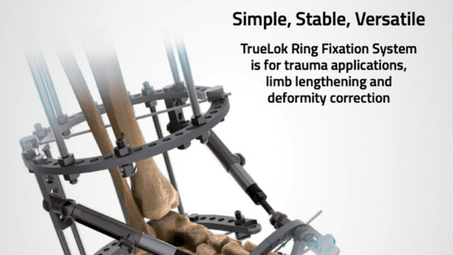 TrueLok Ring Fixation System catalog