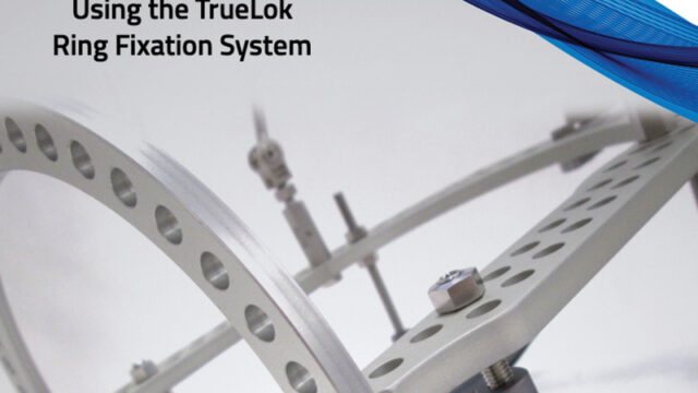TrueLok Ring Fixation System
