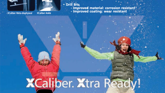 XCaliber Meta-Diaphyseal Fixator in use by people jumping