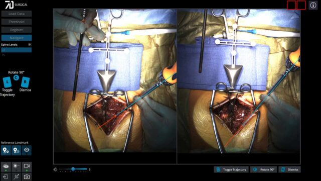 surgical view