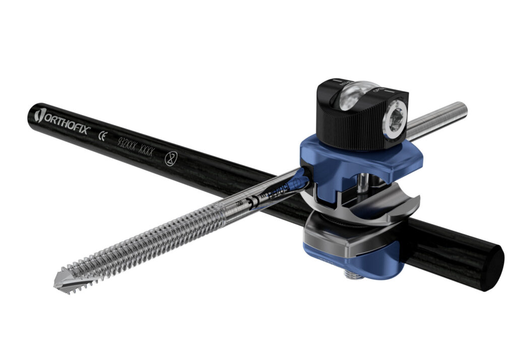 Galaxy Fixation Clamp Design