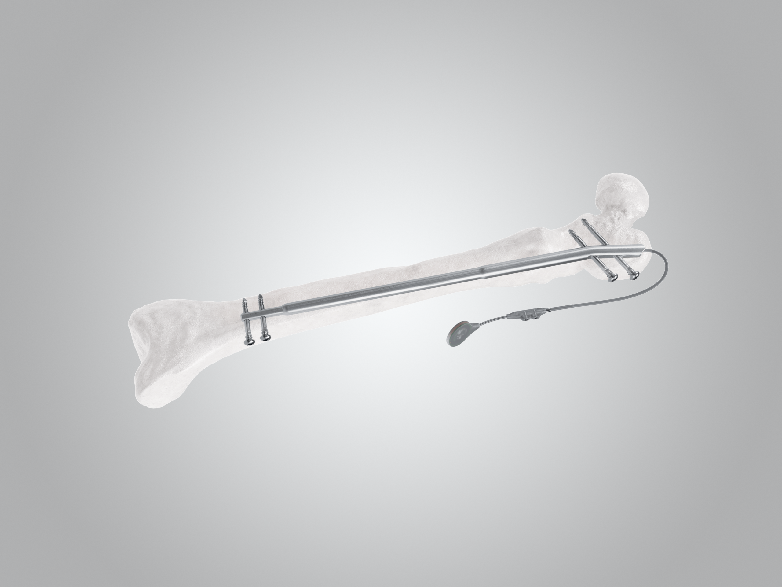 Fitbone Primary image