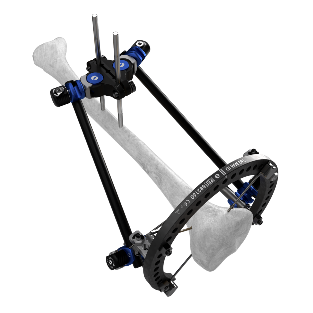 Galaxy Gemini system in use with TrueLok system