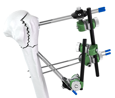 Galaxy Shoulder frame configuration