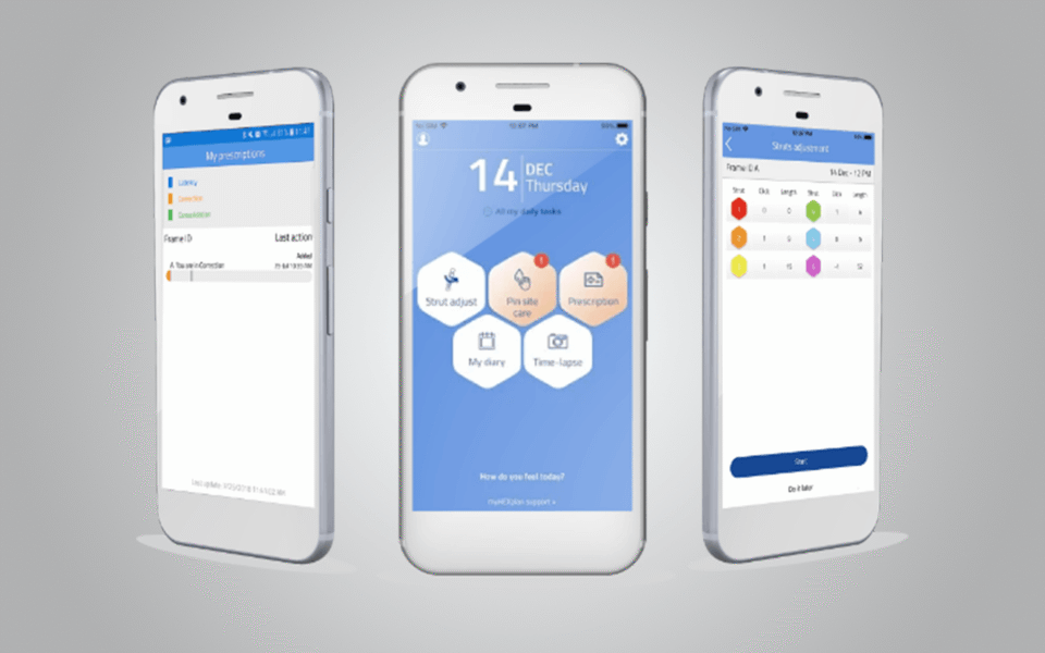 MyHEXplan