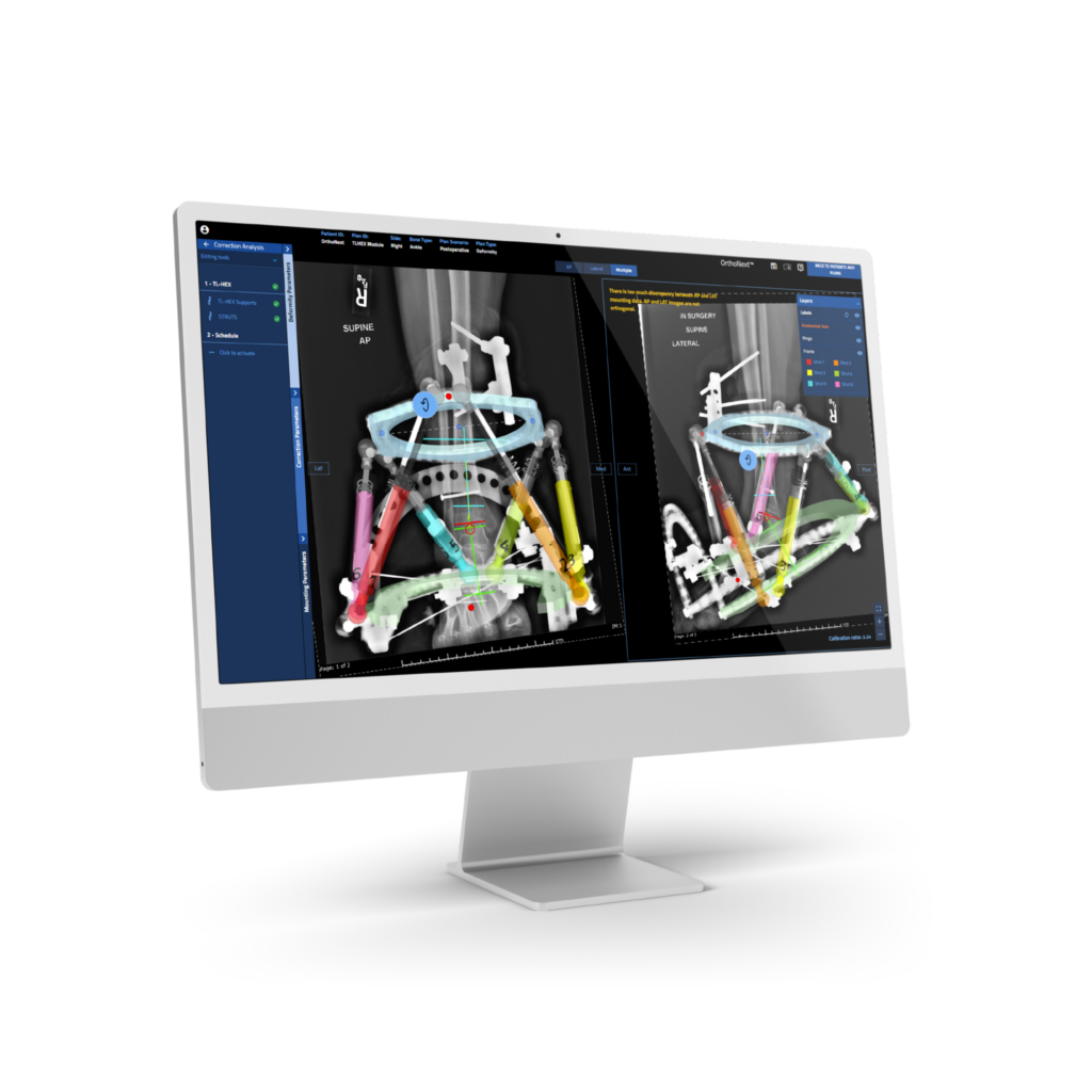 TL-HEX workflow planning on monitor