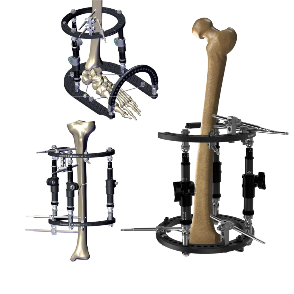 TrueLok EVO multiple frame configuration example